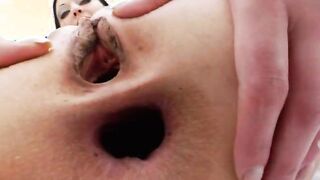 red pepper in my butthole