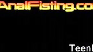 Teen Girls Anal Fisting