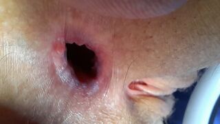 The Great aGape..the final outcome